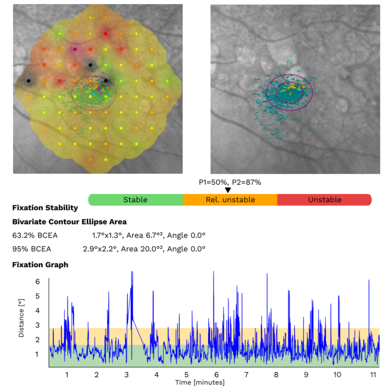 iCare MAIA fixation stability analysis showing preferred retinal locus