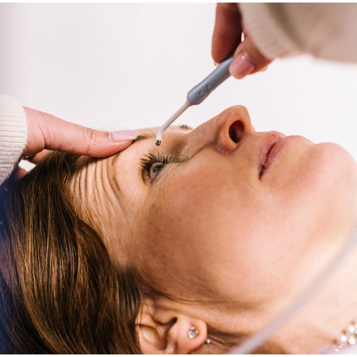 Keeler cryo probe in ophthalmic surgical use