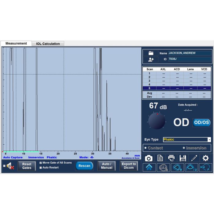 Keeler A-Scan biometry measurement for IOL calculation