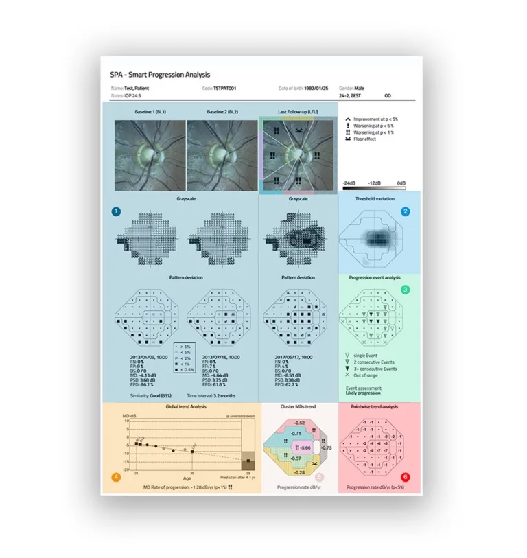 COMPASS Smart Progression Analysis report showing visual field trends