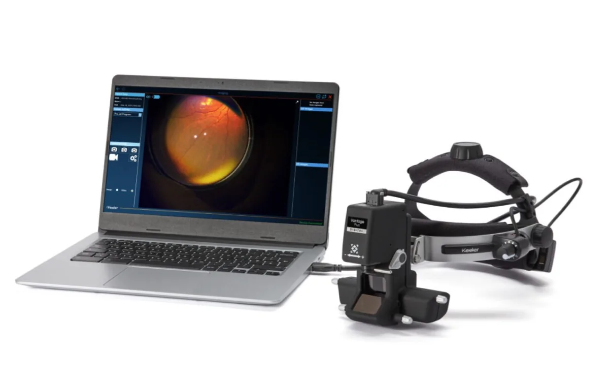 Keeler Kinexis software interface showing retinal image review on laptop