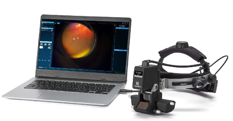Keeler BIO Indirect Ophthalmoscope